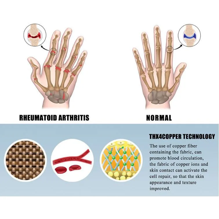 High-Quality Polyester and Cotton Arthritis Gloves, Sport Wrist Support, Joint Compression Gloves for Rheumatoid